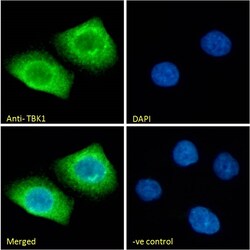 Invitrogen TBK1 Polyclonal Antibody 100 &mu;g; Unconjugated:Antibodies,