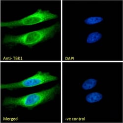 Invitrogen TBK1 Polyclonal Antibody 100 &mu;g; Unconjugated:Antibodies,