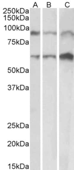 Invitrogen ADAM12 Polyclonal Antibody 100 &mu;g; Unconjugated:Antibodies,