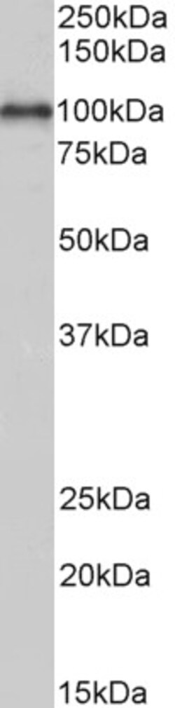Invitrogen ADAM12 Polyclonal Antibody 100 &mu;g; Unconjugated:Antibodies,