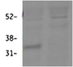 Invitrogen HSD11B1 Polyclonal Antibody 100 &mu;g; Unconjugated:Antibodies,