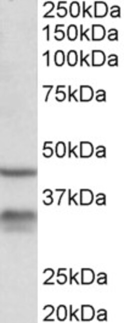 Invitrogen HSD11B1 Polyclonal Antibody 100 &mu;g; Unconjugated:Antibodies,