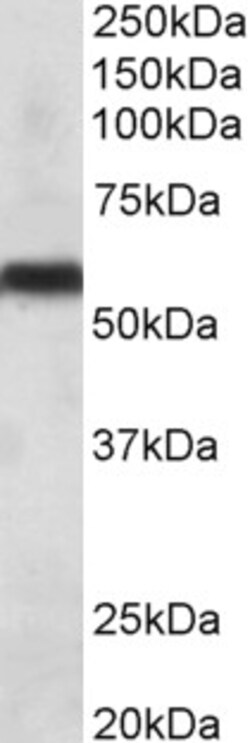 Invitrogen CYP2C8 Polyclonal Antibody 100 &mu;g; Unconjugated:Antibodies,