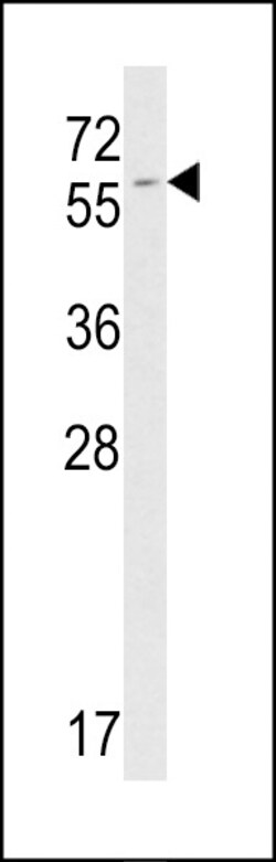 Invitrogen FKBP9 Polyclonal Antibody 400 &mu;L; Unconjugated:Antibodies,