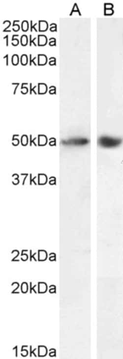 Invitrogen SOX10 Polyclonal Antibody 100 &mu;g; Unconjugated:Antibodies,