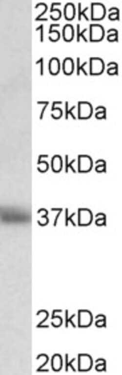 Invitrogen CD7 Polyclonal Antibody 100 &mu;g; Unconjugated:Antibodies,
