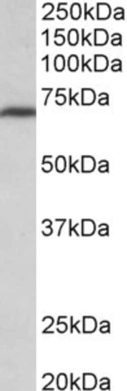 Invitrogen MTHFR Polyclonal Antibody 100 μg; Unconjugated:Antibodies,