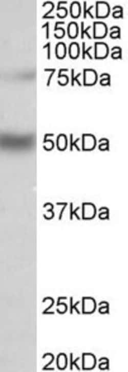 Invitrogen ULK3 Polyclonal Antibody 100 &mu;g; Unconjugated:Antibodies,