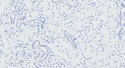 Invitrogen NPR3 Polyclonal Antibody 100 &mu;g; Unconjugated:Antibodies,