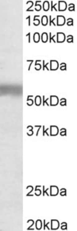 Invitrogen NPR3 Polyclonal Antibody 100 &mu;g; Unconjugated:Antibodies,