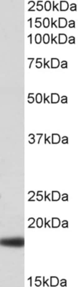 Invitrogen Haptoglobin alpha Polyclonal Antibody 100 &mu;g; Unconjugated:Antibodies,