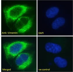 Invitrogen Vimentin Polyclonal Antibody 100 &mu;g; Unconjugated:Antibodies,