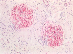 Invitrogen Vimentin Polyclonal Antibody 100 &mu;g; Unconjugated:Antibodies,