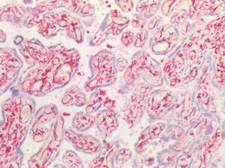 Invitrogen Vimentin Polyclonal Antibody 100 &mu;g; Unconjugated:Antibodies,
