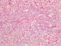 Invitrogen Vimentin Polyclonal Antibody 100 &mu;g; Unconjugated:Antibodies,
