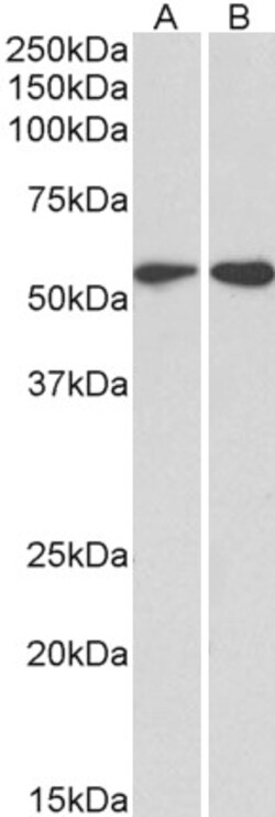 Invitrogen Vimentin Polyclonal Antibody 100 &mu;g; Unconjugated:Antibodies,