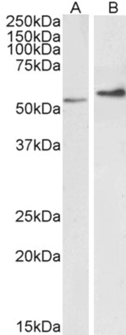 Invitrogen Vimentin Polyclonal Antibody 100 &mu;g; Unconjugated:Antibodies,