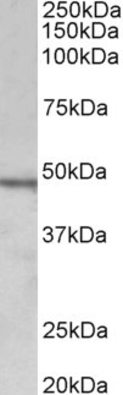 Invitrogen Chitotriosidase Polyclonal Antibody 100 &mu;g; Unconjugated:Antibodies,