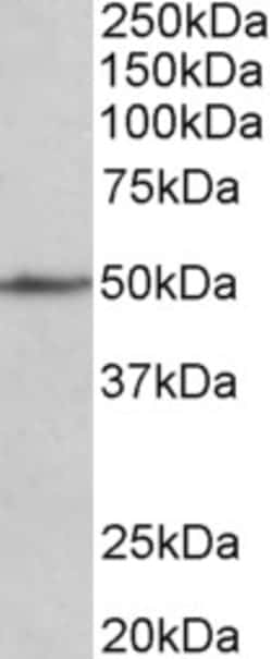 Invitrogen CADM1 Polyclonal Antibody 100 μg; Unconjugated:Antibodies,