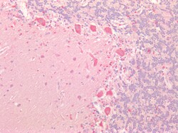 Invitrogen beta-3 Adrenergic Receptor Polyclonal Antibody 100 &mu;g; Unconjugated:Antibodies,