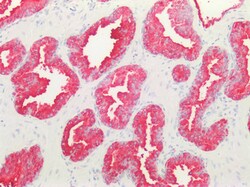 Invitrogen beta-3 Adrenergic Receptor Polyclonal Antibody 100 &mu;g; Unconjugated:Antibodies,