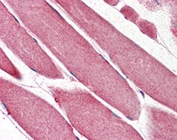 Invitrogen RNF92 Polyclonal Antibody 100 &mu;g; Unconjugated:Antibodies,