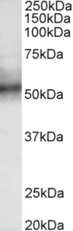 Invitrogen RNF92 Polyclonal Antibody 100 &mu;g; Unconjugated:Antibodies,