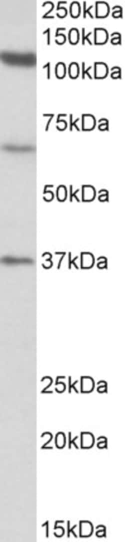 Invitrogen CP110 Polyclonal Antibody 100 &mu;g; Unconjugated:Antibodies,