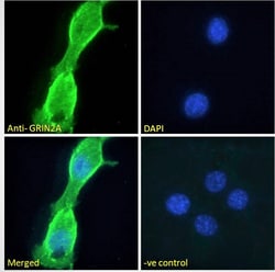 Invitrogen NMDAR2A Polyclonal Antibody 100 &mu;g; Unconjugated:Antibodies,