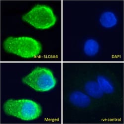 Invitrogen SLC6A4 Polyclonal Antibody 100 &mu;g; Unconjugated:Antibodies,
