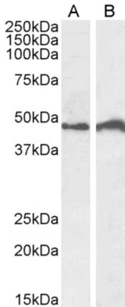 Invitrogen IRF4 Polyclonal Antibody 100 &mu;g; Unconjugated:Antibodies,