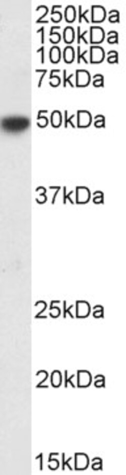 Invitrogen IRF4 Polyclonal Antibody 100 &mu;g; Unconjugated:Antibodies,