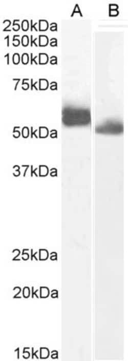Invitrogen IRF4 Polyclonal Antibody 100 &mu;g; Unconjugated:Antibodies,