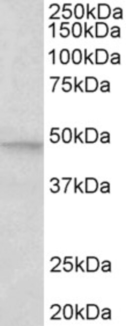 Invitrogen JNK2 beta Polyclonal Antibody 100 &mu;g; Unconjugated:Antibodies,
