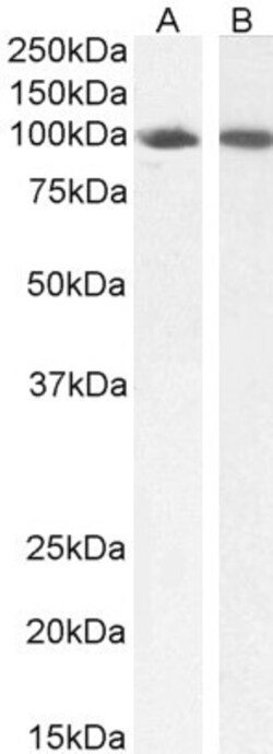 Invitrogen STAT5 alpha Polyclonal Antibody 100 &mu;g; Unconjugated:Antibodies,