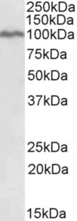Invitrogen STAT5 alpha Polyclonal Antibody 100 &mu;g; Unconjugated:Antibodies,