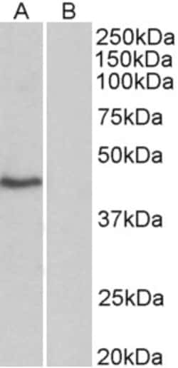 Invitrogen TBP Polyclonal Antibody 100 μg; Unconjugated:Antibodies,