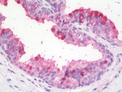 Invitrogen ZBTB24 Polyclonal Antibody 100 &mu;g | Buy Online | Invitrogen&trade; | Fisher Scientific