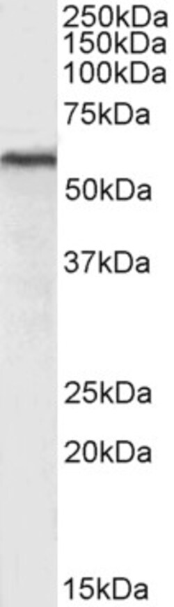 Invitrogen HDAC2 Polyclonal Antibody 100 &mu;g | Buy Online | Invitrogen&trade; | Fisher Scientific