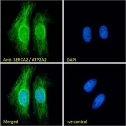 Invitrogen SERCA2 ATPase Polyclonal Antibody 100 &mu;g; Unconjugated:Antibodies,