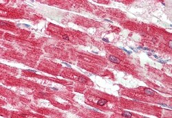Invitrogen SERCA2 ATPase Polyclonal Antibody 100 &mu;g; Unconjugated:Antibodies,