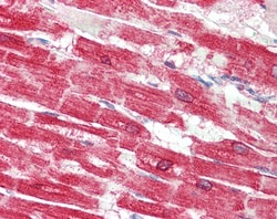 Invitrogen SERCA2 ATPase Polyclonal Antibody 100 &mu;g; Unconjugated:Antibodies,