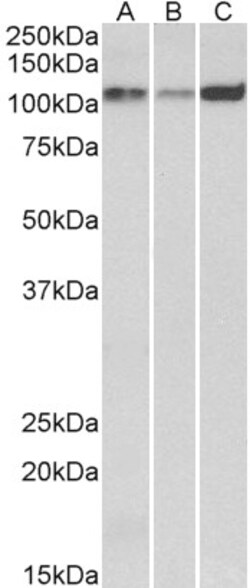 Invitrogen SERCA2 ATPase Polyclonal Antibody 100 &mu;g; Unconjugated:Antibodies,