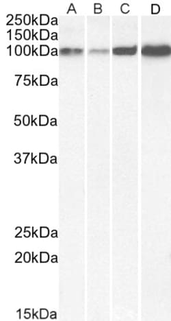 Invitrogen SERCA2 ATPase Polyclonal Antibody 100 &mu;g; Unconjugated:Antibodies,