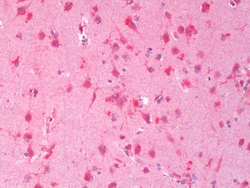 Invitrogen DVL1 Polyclonal Antibody 100 &mu;g; Unconjugated:Antibodies,