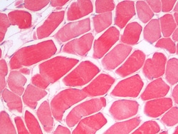Invitrogen DVL1 Polyclonal Antibody 100 &mu;g; Unconjugated:Antibodies,
