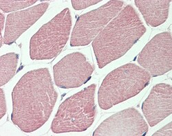 Invitrogen DVL1 Polyclonal Antibody 100 &mu;g; Unconjugated:Antibodies,