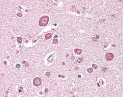 Invitrogen&trade;&nbsp;SDCCAG8 Polyclonal Antibody