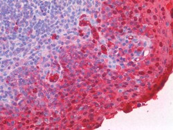 Invitrogen S100A8 Polyclonal Antibody 100 &mu;g; Unconjugated:Antibodies,