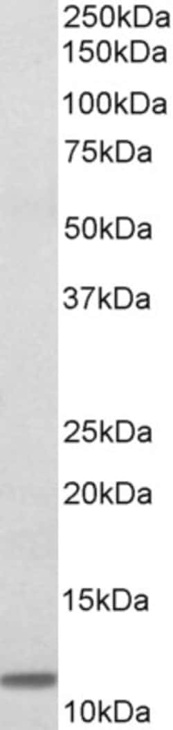Invitrogen beta-2 Microglobulin Polyclonal Antibody 100 &mu;g; Unconjugated:Antibodies,